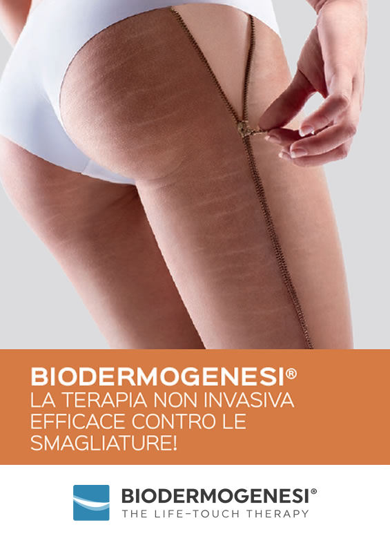 Rigenera le tue smagliature