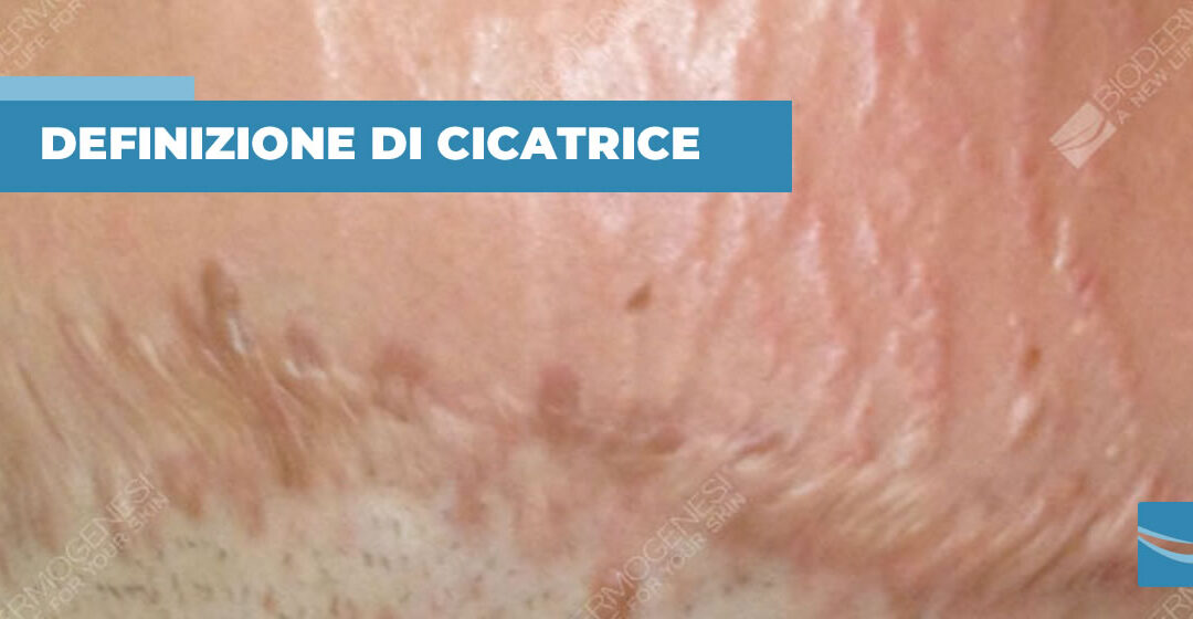 Descrizione e definizione di cicatrice