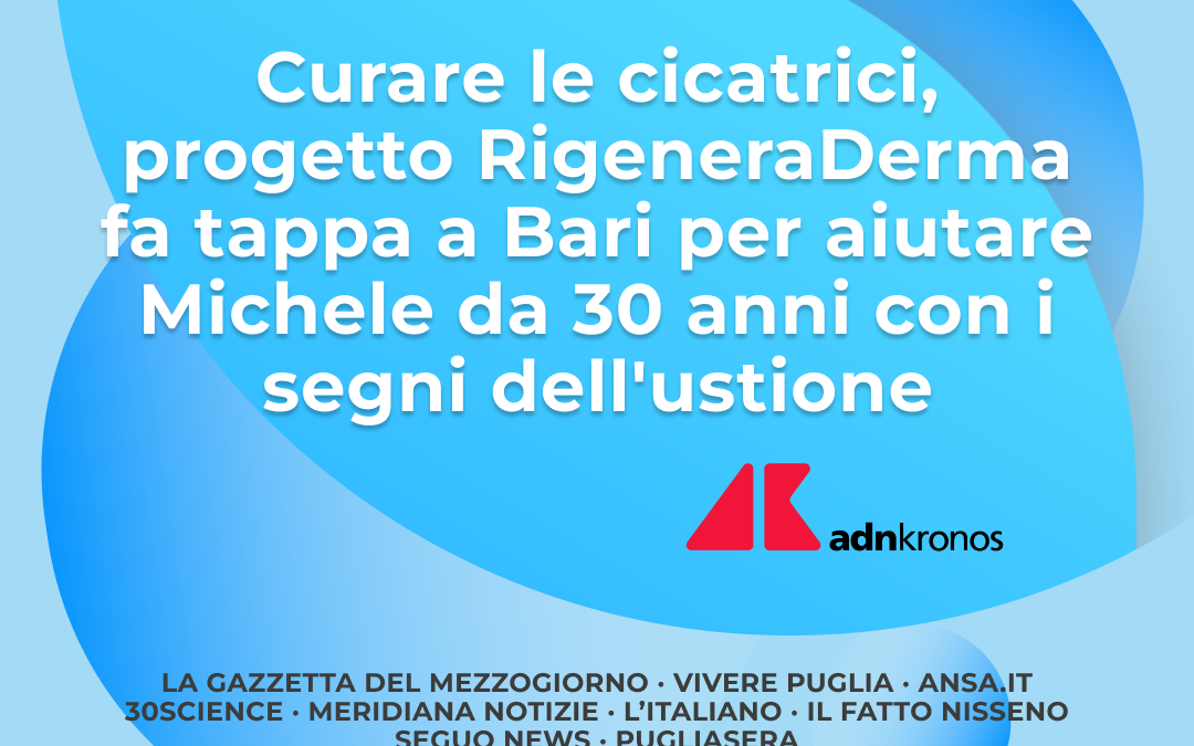 PROGETTO RIGENERADERMA FA TAPPA A BARI PER AIUTARE MICHELE DA 30 ANNI CON I SEGNI DELL’USTIONE